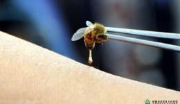 蜂针疗法
